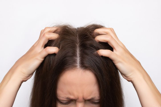 Routine for Itchy Scalp with Dandruff